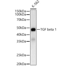Western Blot - Anti-TGF beta 1 Antibody [ARC5123-10] (A309494) - Antibodies.com