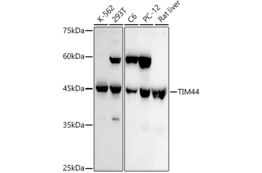 Western Blot - Anti-TIM44 Antibody [ARC3044] (A309495) - Antibodies.com