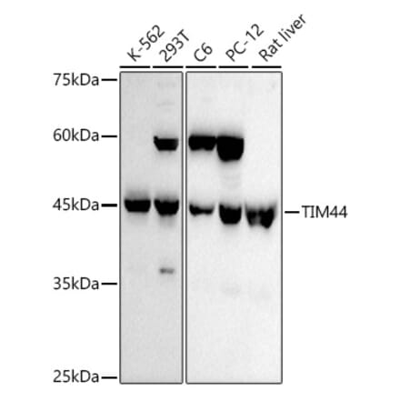 Western Blot - Anti-TIM44 Antibody [ARC3044] (A309495) - Antibodies.com