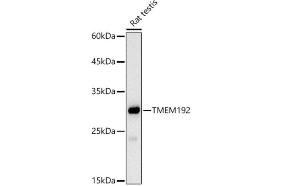 Western Blot - Anti-TMEM192 Antibody [ARC2978] (A309496) - Antibodies.com
