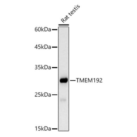 Western Blot - Anti-TMEM192 Antibody [ARC2978] (A309496) - Antibodies.com