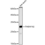 Western Blot - Anti-TMEM192 Antibody [ARC2978] (A309496) - Antibodies.com