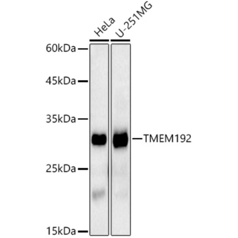 Western Blot - Anti-TMEM192 Antibody [ARC2978] (A309496) - Antibodies.com