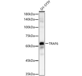Western Blot - Anti-TRAF6 Antibody [ARC60027] (A309498) - Antibodies.com