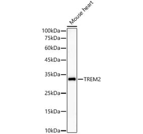 Western Blot - Anti-TREM2 Antibody [ARC59142] (A309499) - Antibodies.com