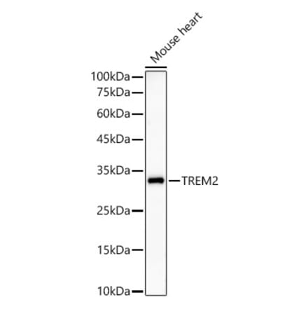 Western Blot - Anti-TREM2 Antibody [ARC59142] (A309499) - Antibodies.com