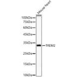 Western Blot - Anti-TREM2 Antibody [ARC59142] (A309499) - Antibodies.com