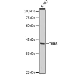 Western Blot - Anti-TRIB3 Antibody [ARC2685] (A309500) - Antibodies.com