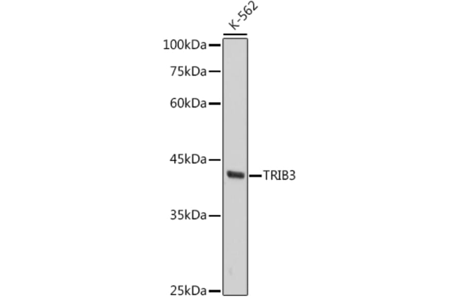 Western Blot - Anti-TRIB3 Antibody [ARC2685] (A309500) - Antibodies.com