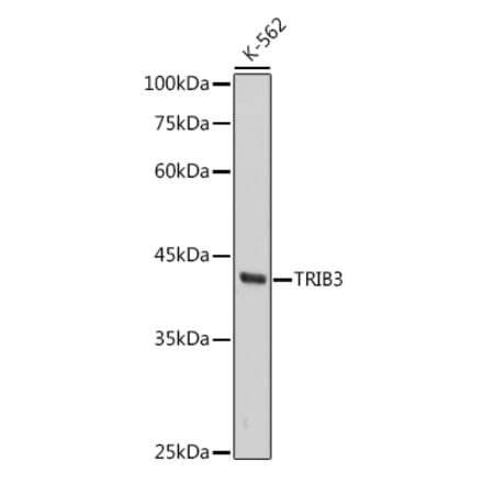 Western Blot - Anti-TRIB3 Antibody [ARC2685] (A309500) - Antibodies.com