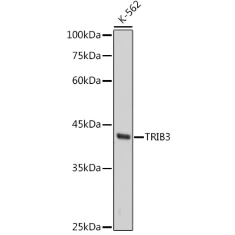 Western Blot - Anti-TRIB3 Antibody [ARC2685] (A309500) - Antibodies.com