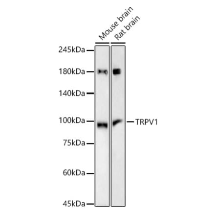 Western Blot - Anti-TRPV1 Antibody [ARC57842] (A309502) - Antibodies.com