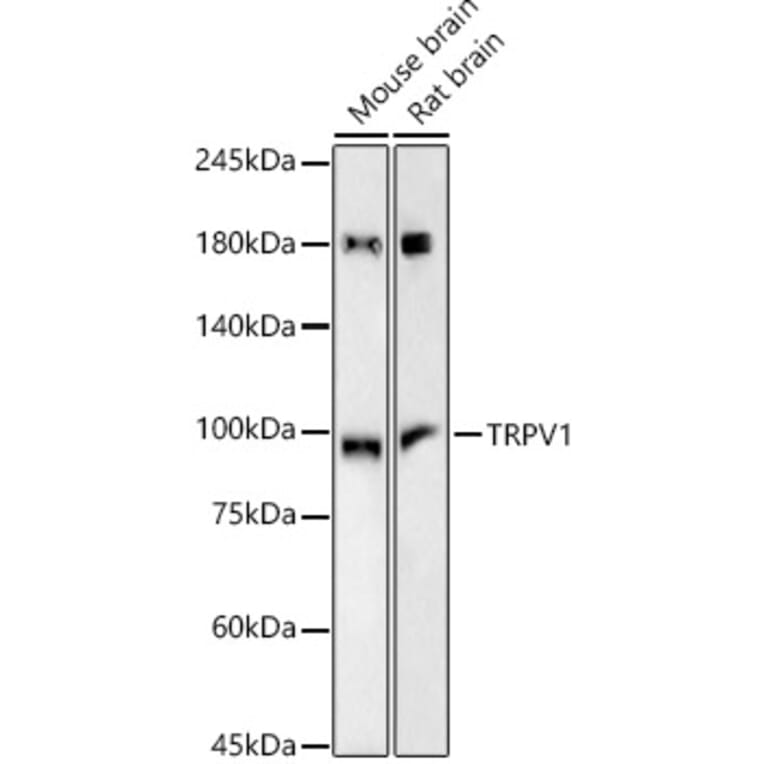 Western Blot - Anti-TRPV1 Antibody [ARC57842] (A309502) - Antibodies.com