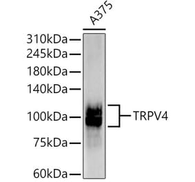 Western Blot - Anti-TRPV4 Antibody [ARC58721] (A309503) - Antibodies.com