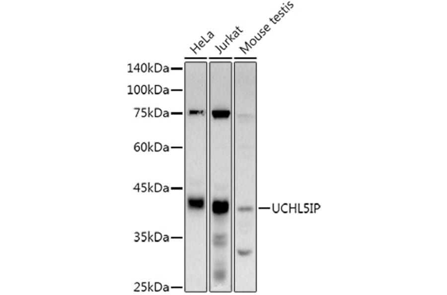 Western Blot - Anti-UCHL5IP Antibody [ARC3021] (A309504) - Antibodies.com