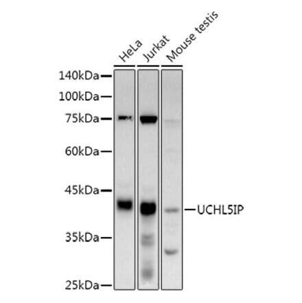 Western Blot - Anti-UCHL5IP Antibody [ARC3021] (A309504) - Antibodies.com