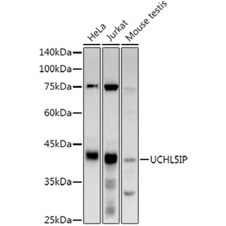 Western Blot - Anti-UCHL5IP Antibody [ARC3021] (A309504) - Antibodies.com