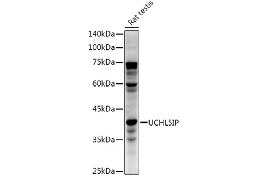 Western Blot - Anti-UCHL5IP Antibody [ARC3021] (A309504) - Antibodies.com