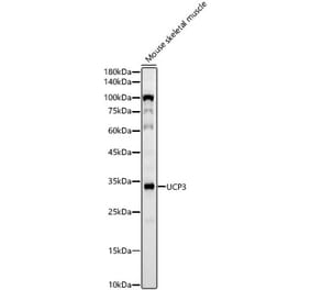 Western Blot - Anti-UCP3 Antibody [ARC60308] (A309505) - Antibodies.com