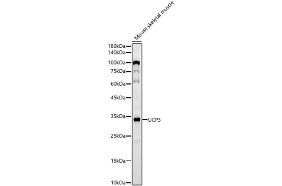 Western Blot - Anti-UCP3 Antibody [ARC60308] (A309505) - Antibodies.com