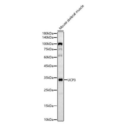 Western Blot - Anti-UCP3 Antibody [ARC60308] (A309505) - Antibodies.com
