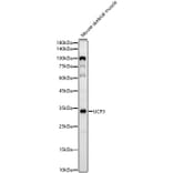 Western Blot - Anti-UCP3 Antibody [ARC60308] (A309505) - Antibodies.com