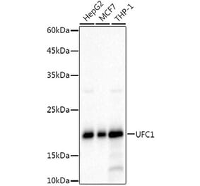 Western Blot - Anti-UFC1 Antibody [ARC3001] (A309506) - Antibodies.com
