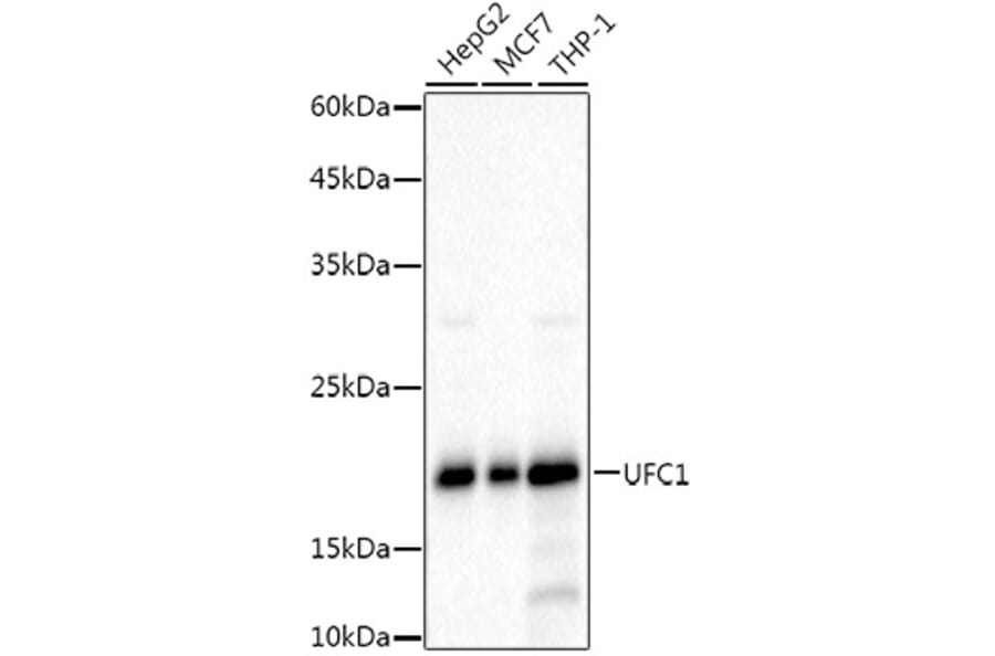 Western Blot - Anti-UFC1 Antibody [ARC3001] (A309506) - Antibodies.com