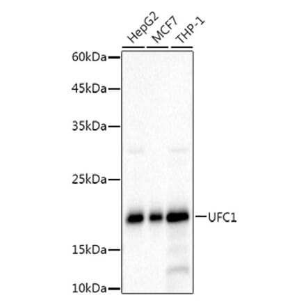 Western Blot - Anti-UFC1 Antibody [ARC3001] (A309506) - Antibodies.com