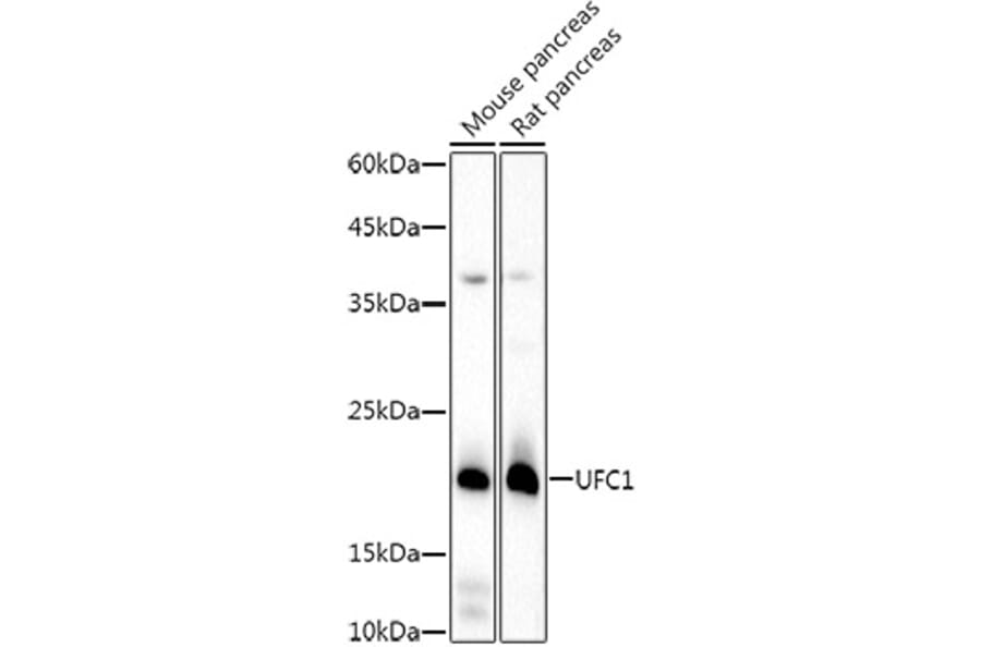 Western Blot - Anti-UFC1 Antibody [ARC3001] (A309506) - Antibodies.com