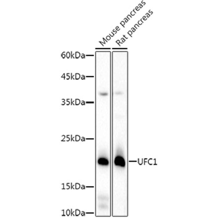 Western Blot - Anti-UFC1 Antibody [ARC3001] (A309506) - Antibodies.com