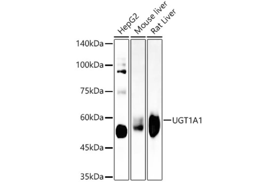 Western Blot - Anti-UGT1A1 Antibody [ARC57754] (A309507) - Antibodies.com