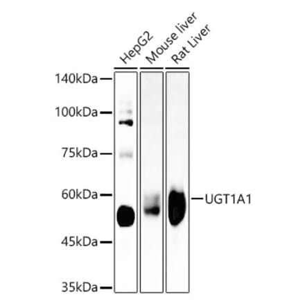 Western Blot - Anti-UGT1A1 Antibody [ARC57754] (A309507) - Antibodies.com