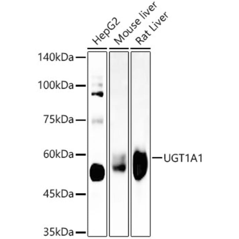 Western Blot - Anti-UGT1A1 Antibody [ARC57754] (A309507) - Antibodies.com