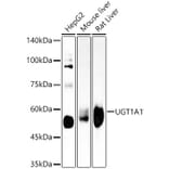 Western Blot - Anti-UGT1A1 Antibody [ARC57754] (A309507) - Antibodies.com
