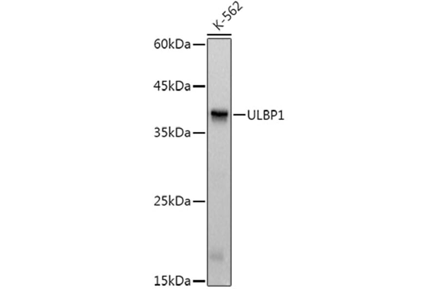 Western Blot - Anti-ULBP1 Antibody [ARC3064] (A309508) - Antibodies.com