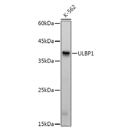 Western Blot - Anti-ULBP1 Antibody [ARC3064] (A309508) - Antibodies.com