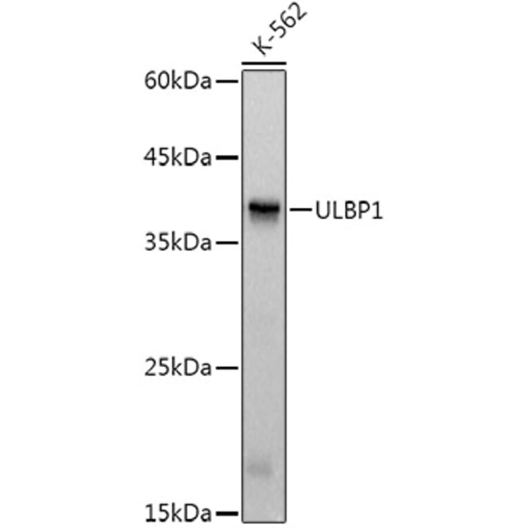 Western Blot - Anti-ULBP1 Antibody [ARC3064] (A309508) - Antibodies.com