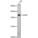 Western Blot - Anti-ULBP1 Antibody [ARC3064] (A309508) - Antibodies.com