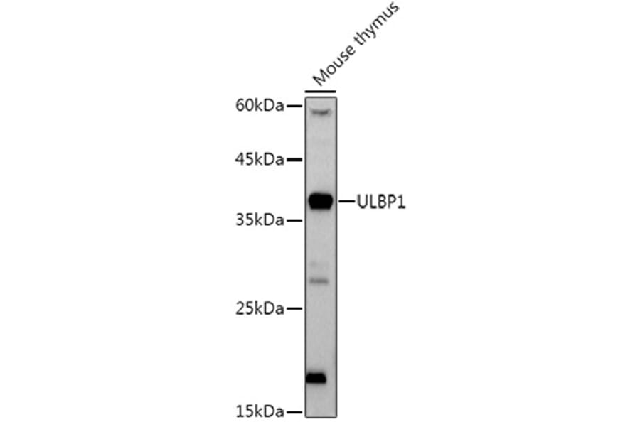 Western Blot - Anti-ULBP1 Antibody [ARC3064] (A309508) - Antibodies.com