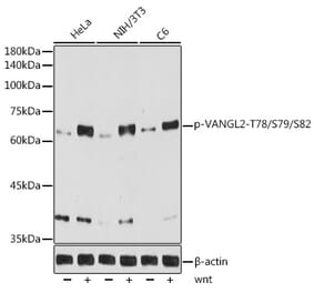 Western Blot - Anti-VANGL2 (phospho Thr78 + Ser79 + Ser82) Antibody [ARC5008-03] (A309510) - Antibodies.com