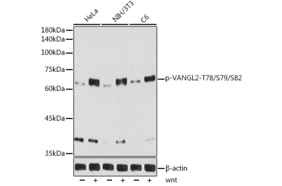 Western Blot - Anti-VANGL2 (phospho Thr78 + Ser79 + Ser82) Antibody [ARC5008-03] (A309510) - Antibodies.com
