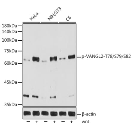 Western Blot - Anti-VANGL2 (phospho Thr78 + Ser79 + Ser82) Antibody [ARC5008-03] (A309510) - Antibodies.com