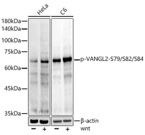 Western Blot - Anti-VANGL2 (phospho Ser79 + Ser82 + Ser84) Antibody [ARC5022-03] (A309511) - Antibodies.com