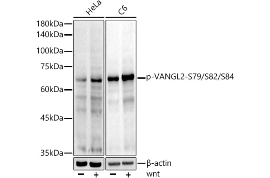 Western Blot - Anti-VANGL2 (phospho Ser79 + Ser82 + Ser84) Antibody [ARC5022-03] (A309511) - Antibodies.com