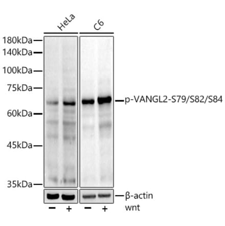 Western Blot - Anti-VANGL2 (phospho Ser79 + Ser82 + Ser84) Antibody [ARC5022-03] (A309511) - Antibodies.com