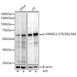 Western Blot - Anti-VANGL2 (phospho Ser79 + Ser82 + Ser84) Antibody [ARC5022-03] (A309511) - Antibodies.com