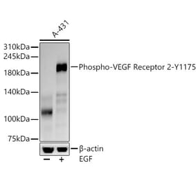 Western Blot - Anti-VEGF Receptor 2 (phospho Tyr1175) Antibody [ARC57293] (A309514) - Antibodies.com