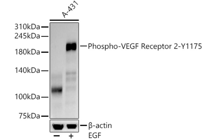Western Blot - Anti-VEGF Receptor 2 (phospho Tyr1175) Antibody [ARC57293] (A309514) - Antibodies.com