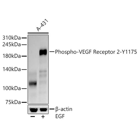 Western Blot - Anti-VEGF Receptor 2 (phospho Tyr1175) Antibody [ARC57293] (A309514) - Antibodies.com